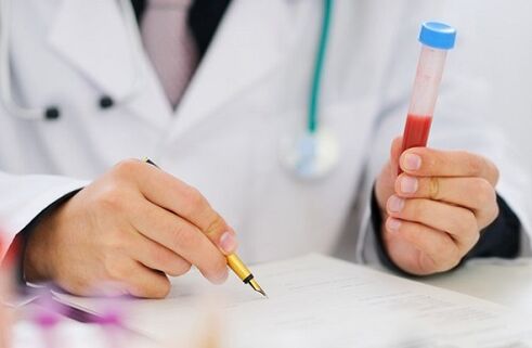 Tests auf Prostatitis, um Medikamente zu verschreiben